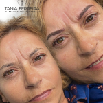 antes-despues