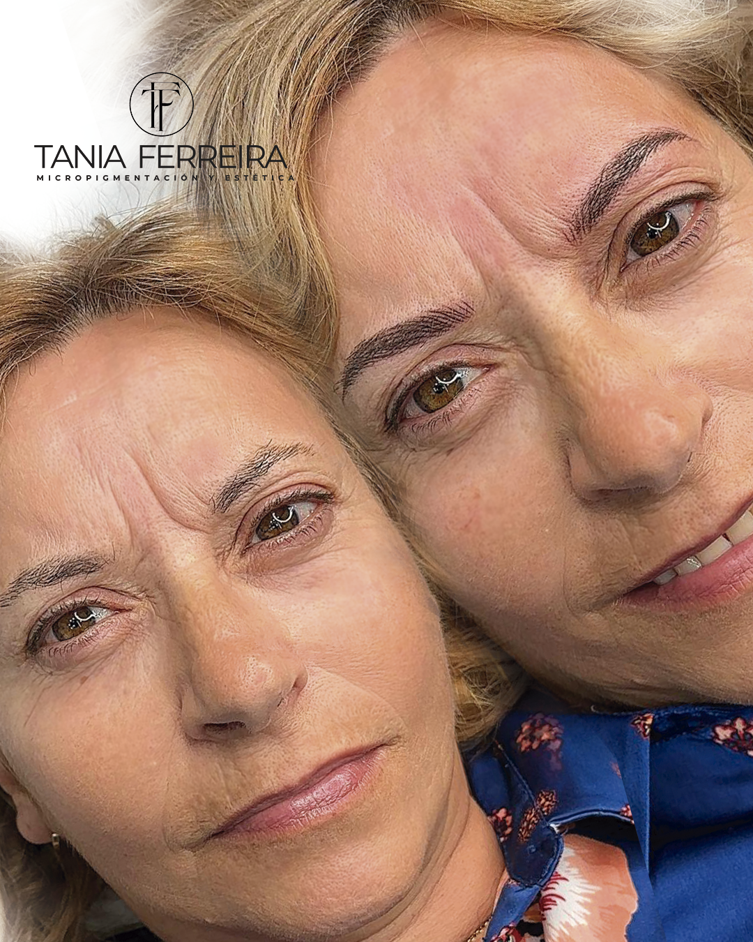 antes-despues